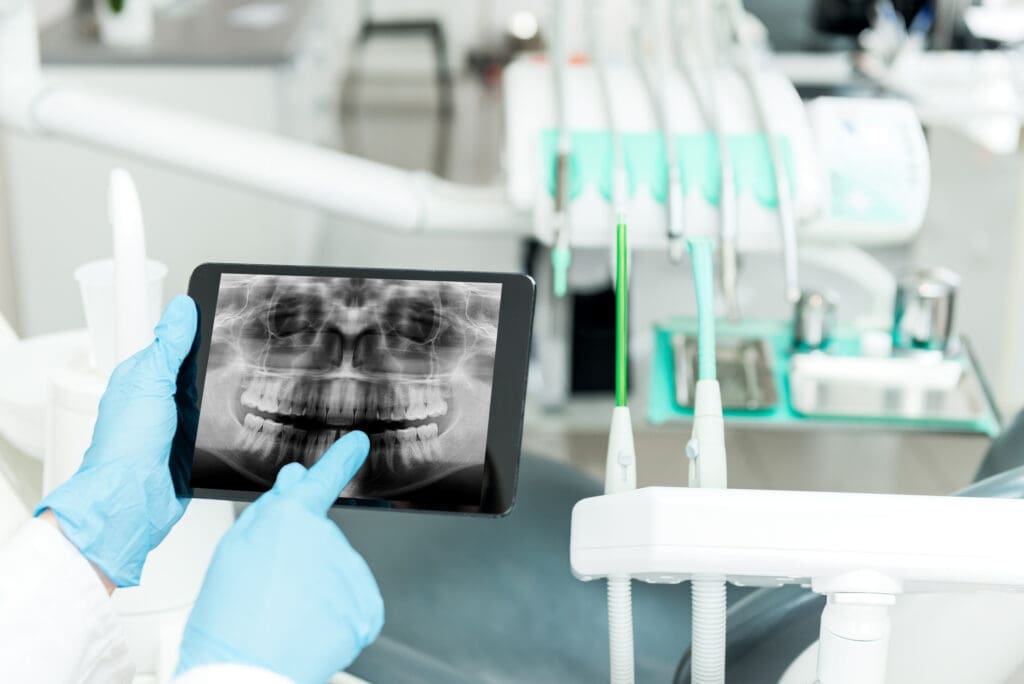 digital dentistry in Emerald Isle, NC